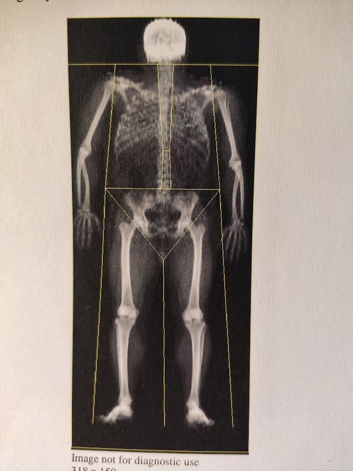 Winter fat or fragile bones? Lotto Soudal riders under the Dexa scan.